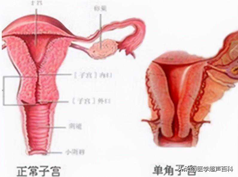 卵巢早衰还可以怀孕吗&锦欣生殖&全面解读：子宫发育异常，生殖系统会否受到
